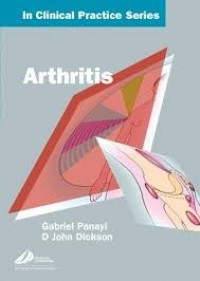 Arthritis