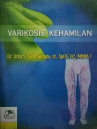 Varikosis Kehamilan