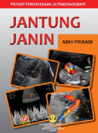 Prinsip Pemeriksaan Ultrasonografi: Jantung Janin